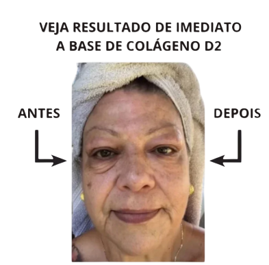 Removedor de Rugas FIRM-A-TITE™